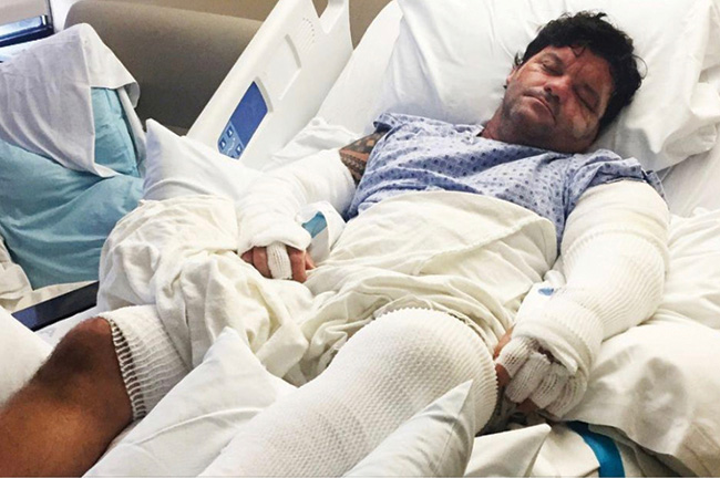 Donovan Smith in the Burn Center Donovan Smith in the Burn Center